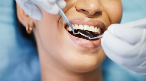 Best Emergency Dentist for Lost Fillings or Crowns in Brookville, OH