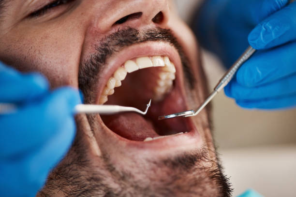 Best Emergency Dentist for Knocked-Out Tooth in Brookville, OH